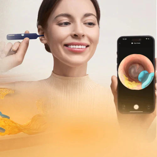 How to Remove Earwax at Home?