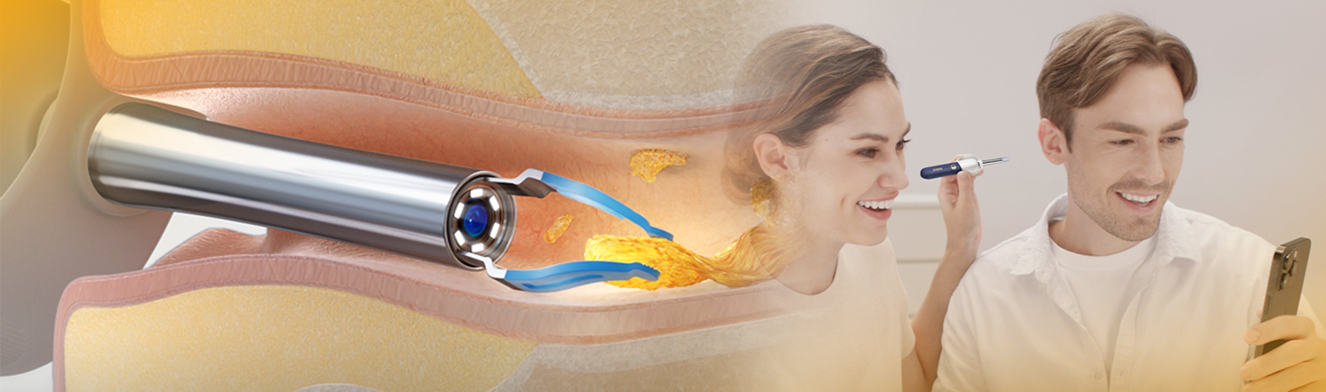 Home Earwax Removal Guide with Safe Tools